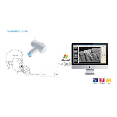 Tratamiento dental portátil del PDA X Ray Machine Camera For Endodontic