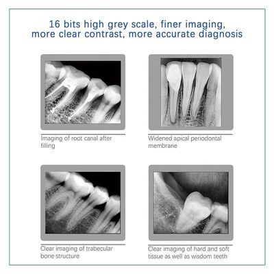 USB X multiusos Ray Dental Machine, PDA inalámbrico X dental Ray Unit