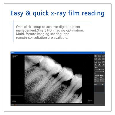 USB X multiusos Ray Dental Machine, PDA inalámbrico X dental Ray Unit