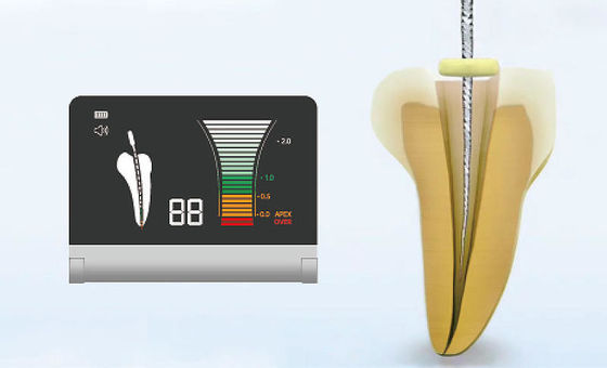 Localizador Endo Motor 50-60Hz de Apex de la aleación de aluminio para el tratamiento de la endodoncia