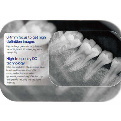 Máquina avanzada de rayos X dentales digitales con sensor de alta resolución