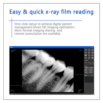 Sensores digitales de rayos X dentales para implantes dentales y tratamiento endodóntico